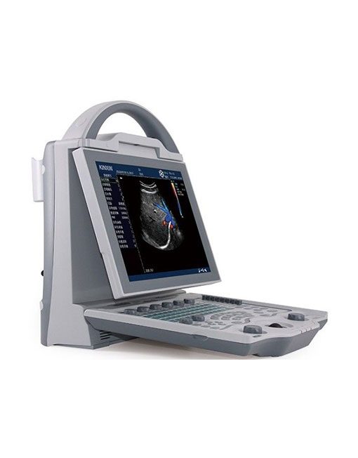 Portable Color Doppler Ultrasound
