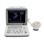 Portable LED screen ultrasound scanner