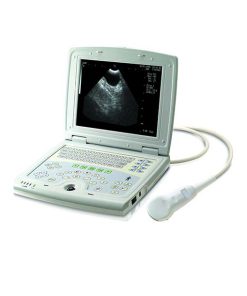 KX5000 Laptop Ultrasound