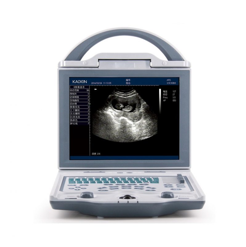 Portable LED screen ultrasound – Afrimedics
