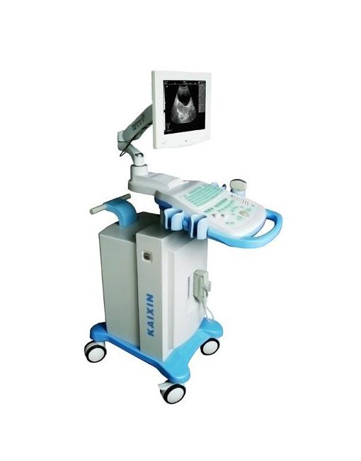 KX2802-Trolley Full digital human B mode ultrasonic diagnostic instruments - Image 4