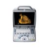 Ultrasound Color Doppler CTS-8800 Plus + 4D convex probe2