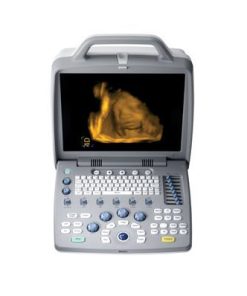 Ultrasound Color Doppler CTS-8800 Plus + 4D convex probe2