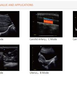 Images of Cardiovascular Color Doppler ECO