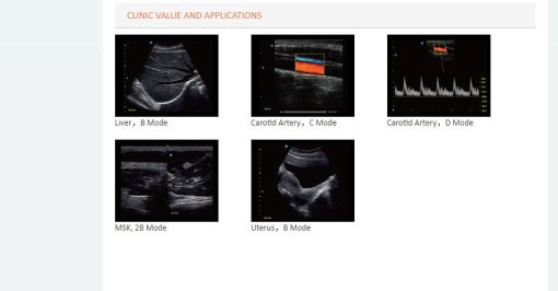 Images of Cardiovascular Color Doppler ECO