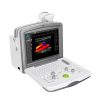 Digital Color Doppler Diagnostic System