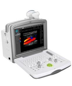 Digital Color Doppler Diagnostic System