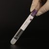 prp-kit-for-joints