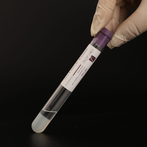 prp-kit-for-joints