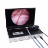 Portable Endoscope Camera 4 in 1