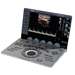 Chison SonoAir 30 Portable Ultrasound System